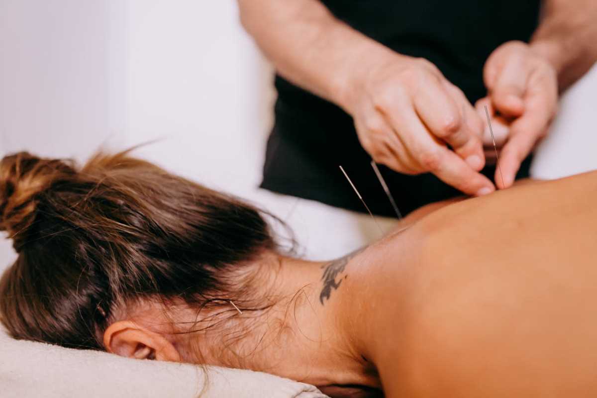 Acupuncture as a Supportive Therapy in Fertility Journeys